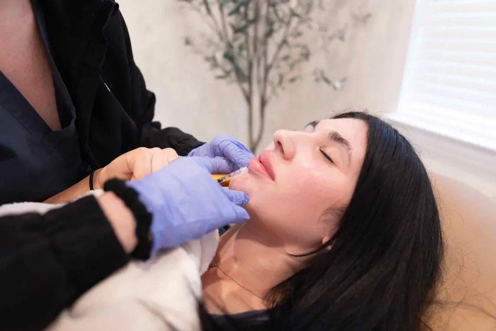 Lip Filler Training
