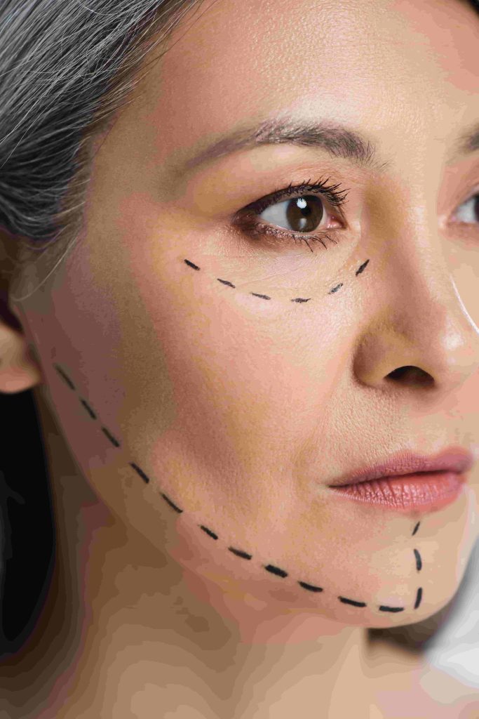Botox for everyone