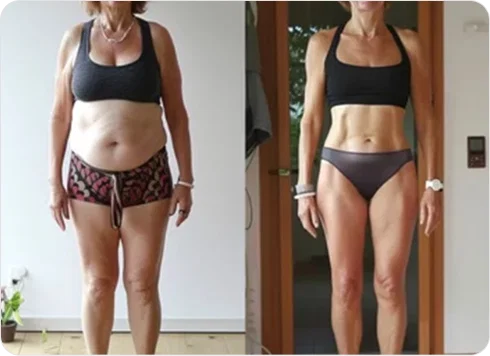 Weight loss injector training